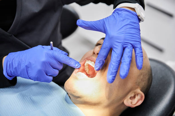 Best Knocked-Out Tooth (Avulsed Tooth) Treatment in Dexter, NM